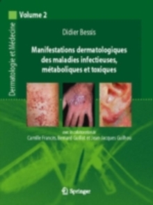 Image for Manifestations dermatologiques des maladies infectieuses, metaboliques et toxiques: Dermatologie et medecine, vol. 2