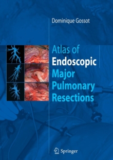 Image for Atlas of endoscopic major pulmonary resections