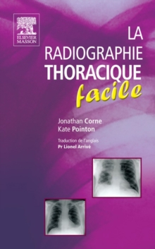 Image for La Radiographie Thoracique Facile