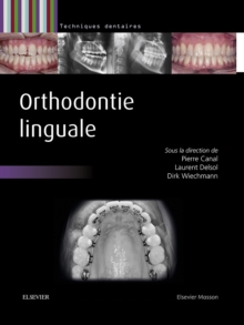Image for Orthodontie linguale