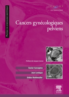 Image for Cancers gynecologiques pelviens