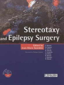 Image for Stereotaxy & Epilepsy Surgery