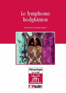 Image for Le lymphome hodgkinien [electronic resource] / Pauline Brice et Delphine Sénécal.