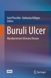 Image for Buruli Ulcer