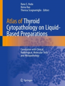 Image for Atlas of Thyroid Cytopathology on Liquid-Based Preparations : Correlation with Clinical, Radiological, Molecular Tests and Histopathology