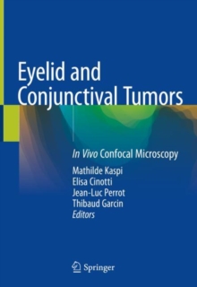 Image for Eyelid and conjunctival tumors  : in vivo confocal microscopy