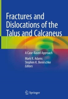 Image for Fractures and Dislocations of the Talus and Calcaneus: A Case-Based Approach