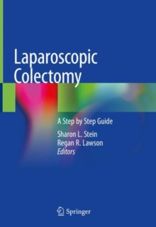 Image for Laparoscopic Colectomy