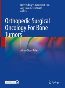 Image for Orthopedic Surgical Oncology For Bone Tumors