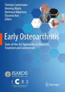 Image for Early Osteoarthritis