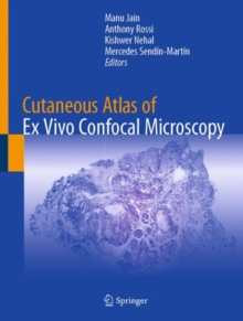 Image for Cutaneous atlas of ex vivo confocal microscopy