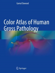 Image for Color atlas of human gross pathology