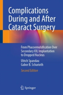 Image for Complications During and After Cataract Surgery