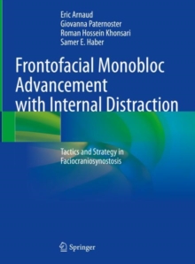 Image for Frontofacial monobloc advancement with internal distraction: tactics and strategy in faciocraniosynostosis