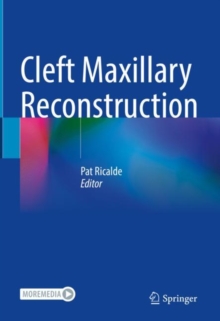 Image for Cleft Maxillary Reconstruction