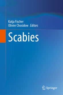Image for Scabies