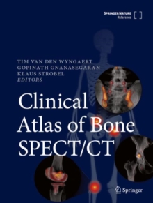 Image for Clinical Atlas of Bone SPECT/CT