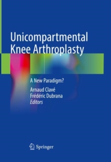 Image for Unicompartmental Knee Arthroplasty