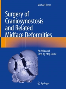 Image for Surgery of Craniosynostosis and Related Midface Deformities