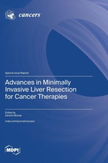 Image for Advances in Minimally Invasive Liver Resection for Cancer Therapies