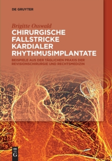 Image for Chirurgische Fallstricke kardialer Rhythmusimplantate : Beispiele aus der taglichen Praxis der Revisionschirurgie und Rechtsmedizin