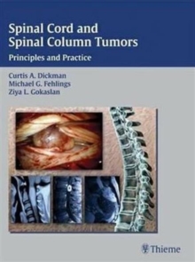 Image for Spinal Cord and Spinal Column Tumors