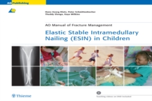 Image for Elastic Stable Intramedullary Nailing (ESIN) in Children