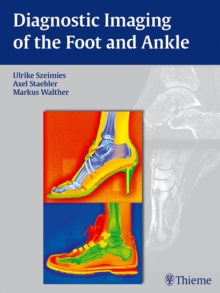 Image for Diagnostic Imaging of the Foot and Ankle