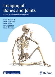 Image for Imaging of Bones and Joints