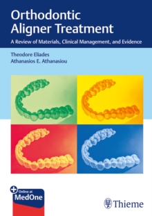 Image for Orthodontic aligner treatment  : a review of materials, clinical management, and evidence