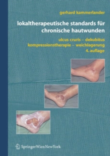 Image for Lokaltherapeutische Standards Fur Chronische Hautwunden