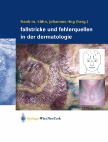 Image for Fallstricke und Fehlerquellen in der Dermatologie