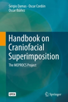 Image for Handbook on Craniofacial Superimposition : The MEPROCS Project
