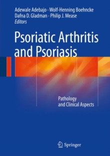 Image for Psoriatic Arthritis and Psoriasis
