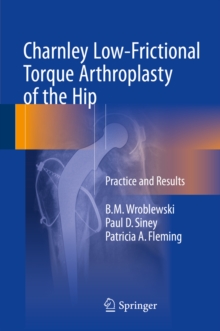 Image for Charnley low-frictional torque arthroplasty of the hip: practice and results