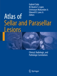Image for Atlas of Sellar and Parasellar Lesions: Clinical, Radiologic, and Pathologic Correlations