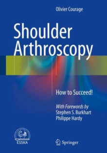 Image for Shoulder arthroscopy  : how to succeed!