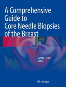 Comprehensive Guide to Core Needle Biopsies of the Breast