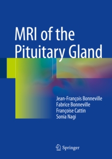 Image for MRI of the Pituitary Gland