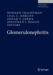 Image for Glomerulonephritis