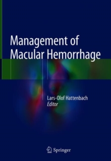 Management of Macular Hemorrhage
