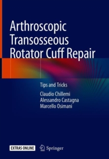 Image for Arthroscopic Transosseous Rotator Cuff Repair