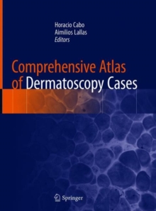Image for Comprehensive Atlas of Dermatoscopy Cases