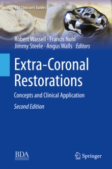 Image for Extra-coronal Restorations: Concepts and Clinical Application
