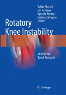 Image for Rotatory Knee Instability