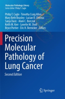 Image for Precision Molecular Pathology of Lung Cancer