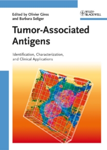 Image for Tumor-associated antigens: identification, characterization, and clinical applications
