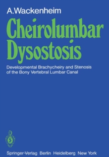 Image for Cheirolumbar Dysostosis