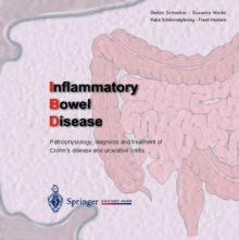 Image for Inflammatory Bowel Disease