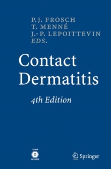 Image for Contact Dermatitis